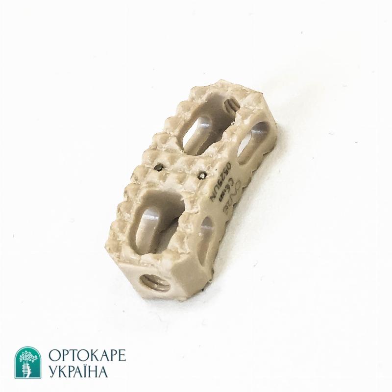 Боковий грудний міжхребцевий кейдж PEEK Ø4 "ORTHO CARE"